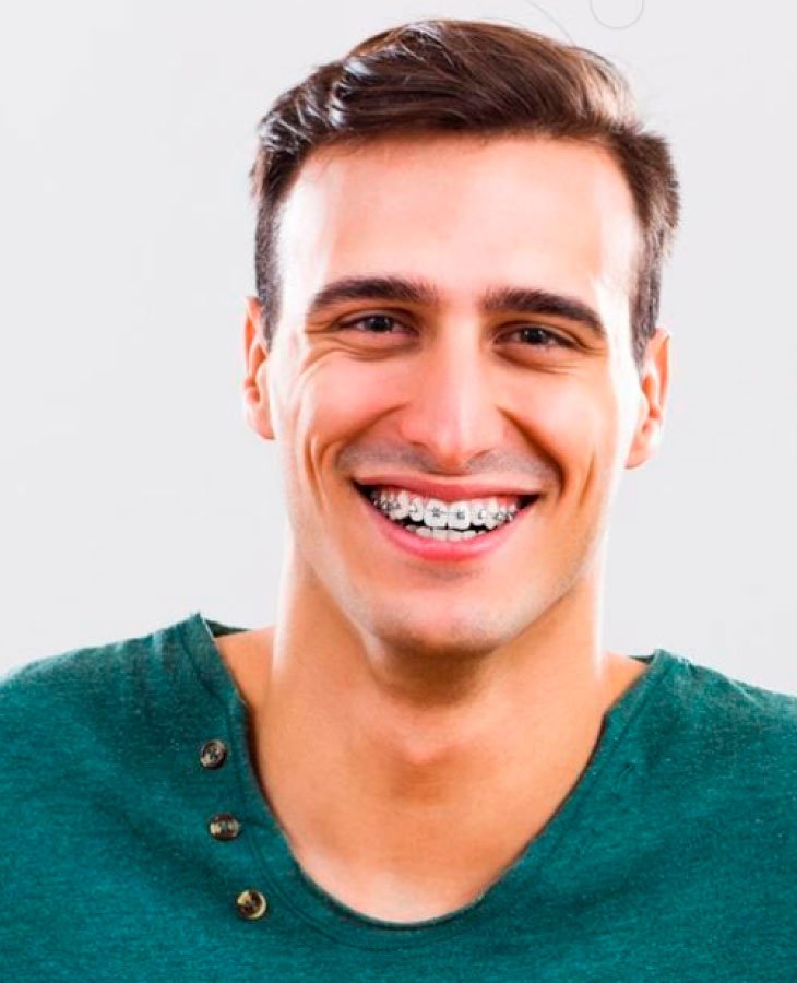 KS-Fogszabalyozo-studio-lathatalan-fogszabalyozas