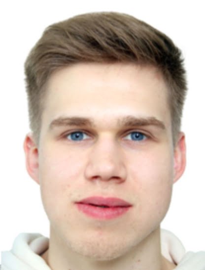 KS-Fogszabalyozo-studio-lathatalan-fogszabalyozas