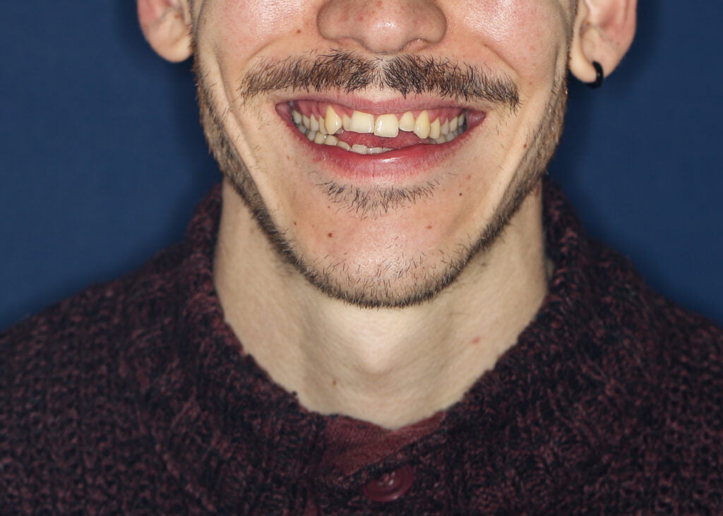 KS-Fogszabalyozo-studio-lathatalan-fogszabalyozas